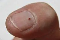 بق الفراش حشرات تسبب الأمراض