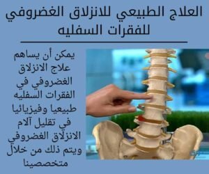 العلاج الطبيعي