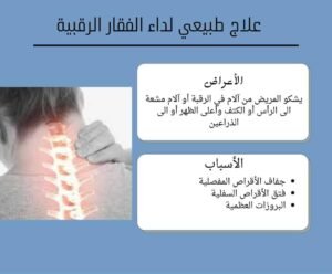 العلاج الطبيعي للفقرات