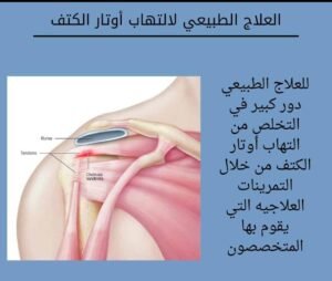 العلاج الطبيعي لالتهاب أوتار الكتف