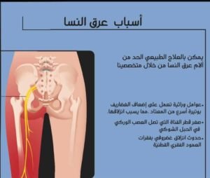 علاج عرق النسا