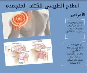 علاج الكتف