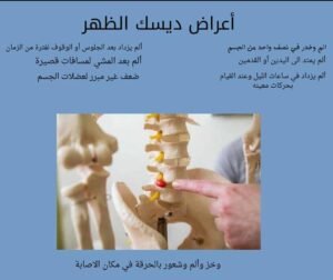اعراض ديسك الظهر