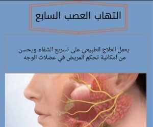 التهاب العصب السابع