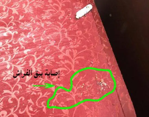 إصابة بحشرات بق الفراش